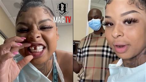 how did chrisean lose tooth|Chrisean Rock Reveals She Is Replacing Her Tooth。